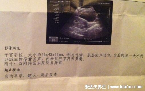 B超单有这个一般是女孩,看孕囊数据/形状/大小(圆形是女宝)