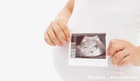 NT三个亮点是男孩女孩,3个亮点男孩/3条线女孩(双腿间)