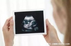 彩超单子上有男女标志，3个亮点是男孩/3条