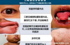 川崎病不能打4种疫苗，水痘/麻疹/腮腺炎/流