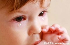 川崎病眼睛红症状图片，还有发热/皮疹/嘴唇