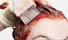 染发膏沾到皮肤上怎么去除，妙用烟灰/醋