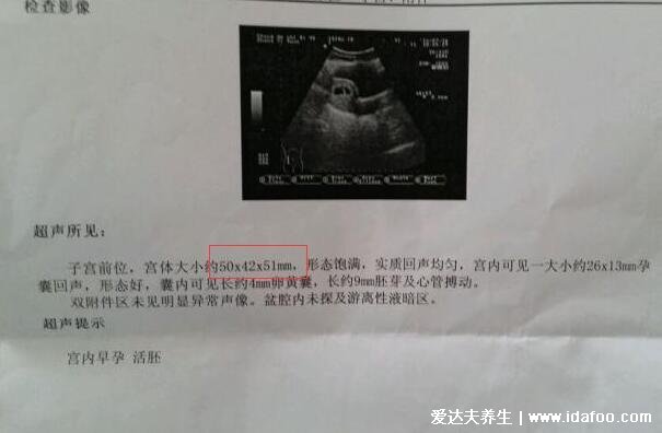 胎心率看胎儿性别,多次检查低于140次/分钟是男孩
