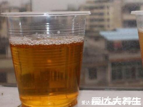 胎心率看胎儿性别,多次检查低于140次/分钟是男孩