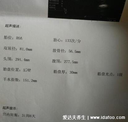 胎心率看胎儿性别,多次检查低于140次/分钟是男孩