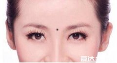 三处有痣菩萨转世，眉心/耳垂/腰上长痣的都