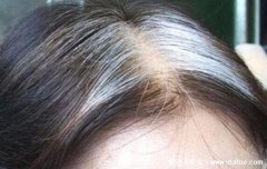 三个部位长白发最危险,前额脾胃失调/头顶