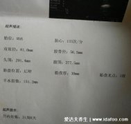 胎心率看胎儿性别,多次检查低于140次/分钟