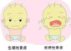 新生儿黄疸一般多久完全退干净，生理性2周