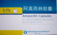 牙龈肿痛十大消炎药,家中常备阿莫西林/甲