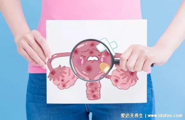 4种人不宜打宫颈癌疫苗,经期女性不宜接种(可能加重经期症状)