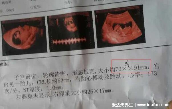 2021准确率100的生男生女公式,看双亲生日可计算(B超等5个公式)