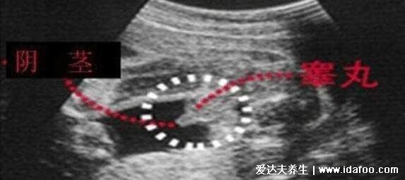 NT三个亮点是男孩女孩图片,是男孩的生殖特点(三条线为女孩)