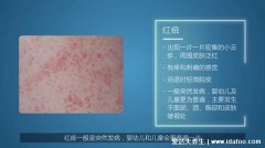 宝宝小儿痱子症状图片,3种类型痱子中热痱