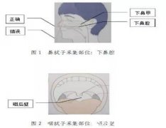 鼻咽拭子采集长度是多少要进去多少厘米，