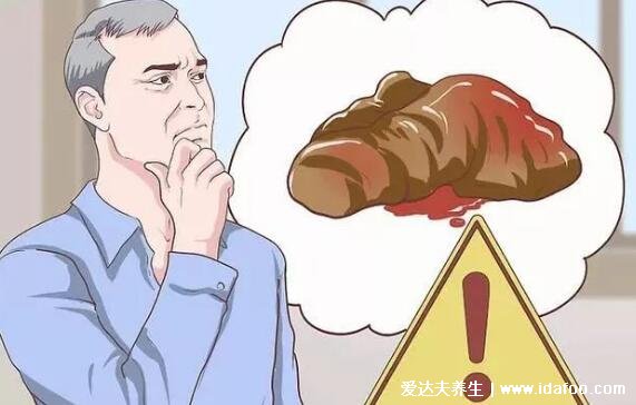 肠癌拉出来大便的图片,警惕4个最为明显的肠癌信号