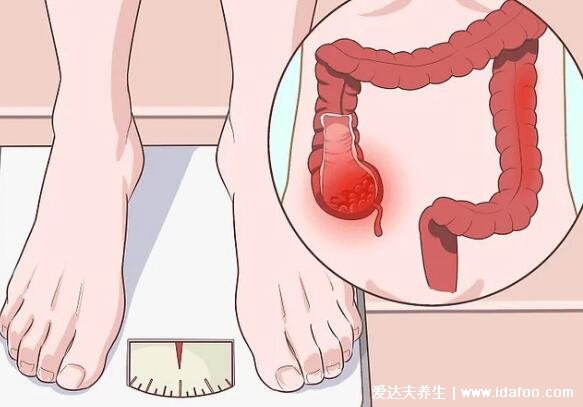 肠癌拉出来大便的图片,警惕4个最为明显的肠癌信号
