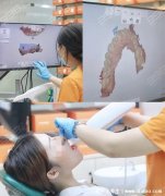 成年以后千万别整牙,因为你会后悔一时(