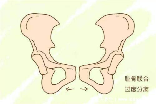耻骨是哪个部位图片,孕期中晚期女性容易耻骨疼