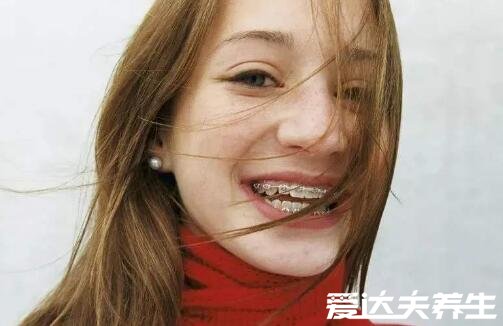 带牙套的年龄,12到18岁最适合带牙套(三大注意事项)