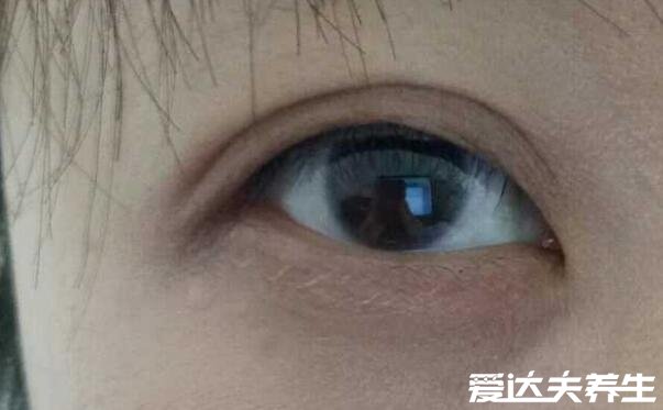 二十种眼形大全图解,第十种葡萄眼眼型最完美漂亮