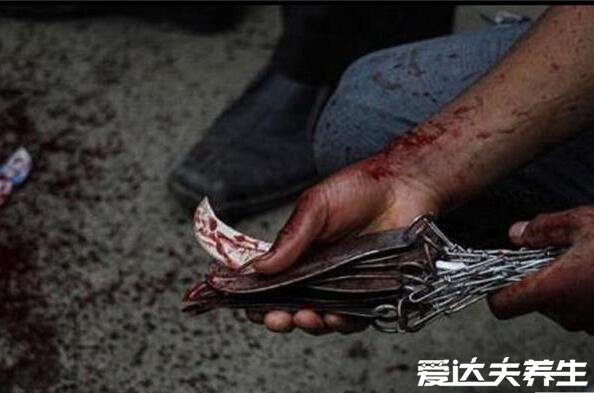 割礼过后的女性是什么样的，留下火柴棍小孔没有性快感只有痛感