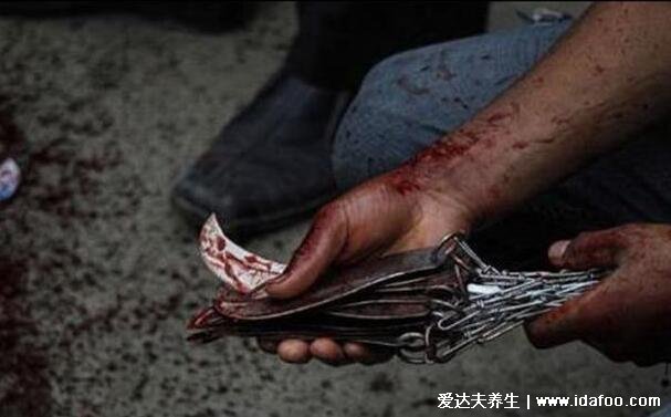 割礼是割女性什么部位，割礼的意义是什么(残忍割掉外生殖器)