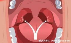 割扁桃体后悔死了,割了更容易感冒生病(尽