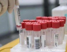 喝酒能做核酸检测吗，不能以免影响到检测