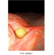 怀孕十月胎儿发育过程图，从胚胎着床到发