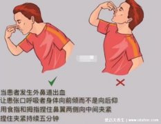 流鼻血的正确止血方法图解，注意仰头举手