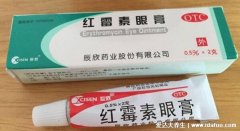 麦粒肿快速消除的方法，涂红霉素眼膏亲测