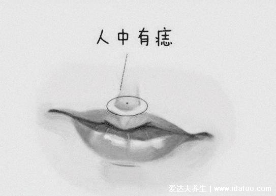 面部哪些痣必须点掉,人中痣和上眼皮的痣(4种痣不吉利)