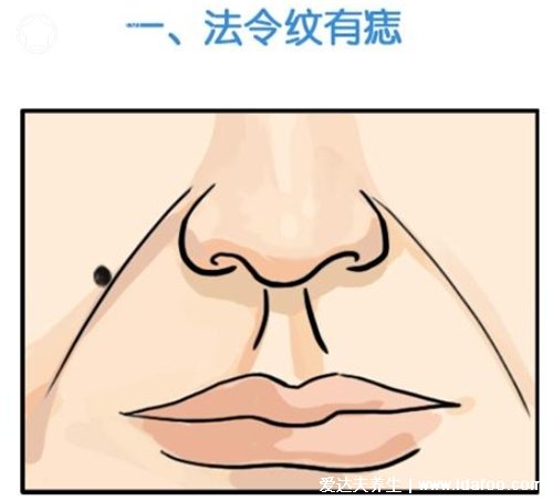 面部哪些痣必须点掉,人中痣和上眼皮的痣(4种痣不吉利)
