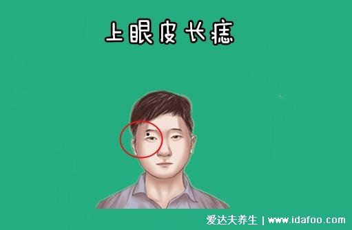 面部哪些痣必须点掉,人中痣和上眼皮的痣(4种痣不吉利)