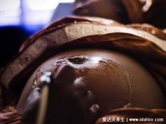 男女割礼是怎么一回事，割除部分生殖器官