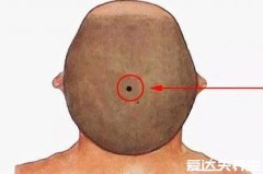 男人10处有痣是富贵痣，在脸上就有7处千万