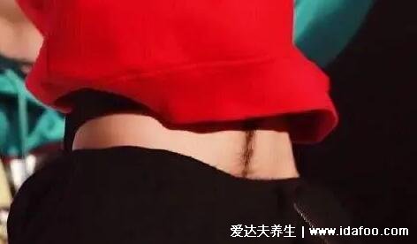 男生长腹毛代表什么,荷尔蒙旺盛X方面强(正常生理现象)