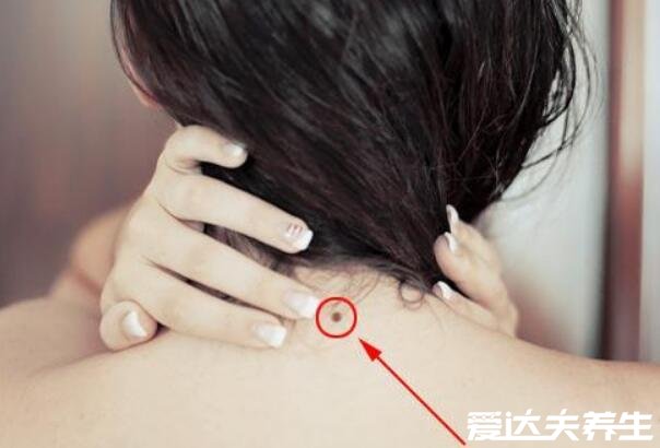 女人10处有痣是富贵痣,鼻侧和这九处长痣财富爱情双丰收