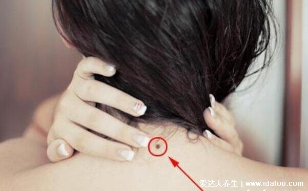 女人身上的10大福痣,脸上就有4处富贵痣别乱点