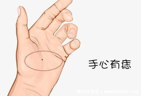 女人身上的10大福痣少见的极富贵痣,屁股有痣财运事业佳