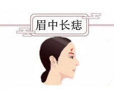 女人痣相图解脸上，眉毛有痣是富贵命(有些