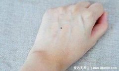 女人左手有痣全图解，左手背有痣的女人感