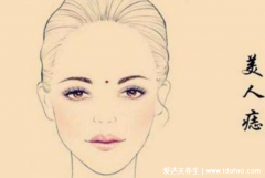 三处有痣菩萨转世，耳垂有痣的人出生便有