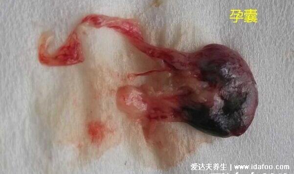 伤害最小的流产方式，药流伤害小但有很多限制和注意事项
