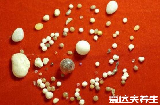 舍利子是什么东西怎么形成的,为高僧火化后的晶体(与饮食有关)
