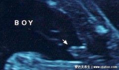 胎儿性别医生早暗示你了，B超有两点基本是
