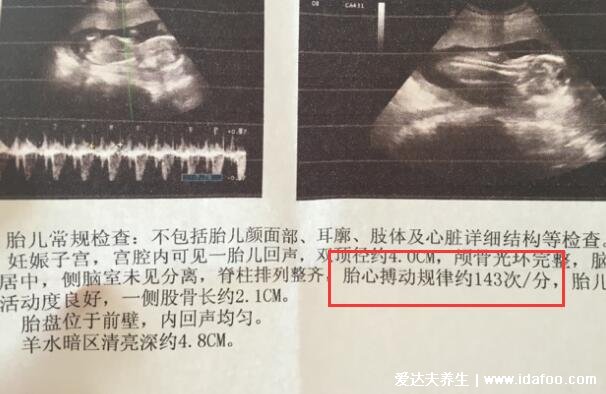 太准了!胎心看男女,胎心率150是男孩还是女孩(女孩可能性大)