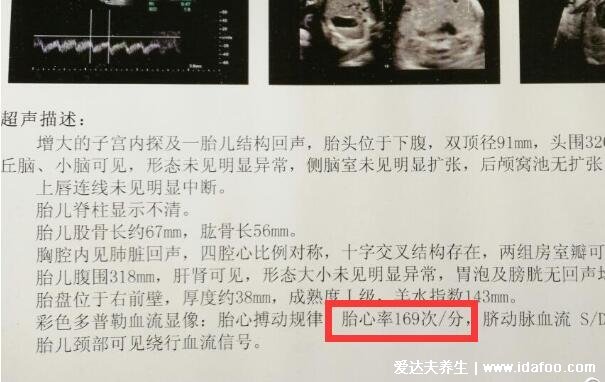 太准了!胎心看男女,胎心率150是男孩还是女孩(女孩可能性大)