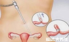 为什么不建议女人上环，妇科疾病患病几率